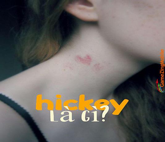hickey-co-la-gi